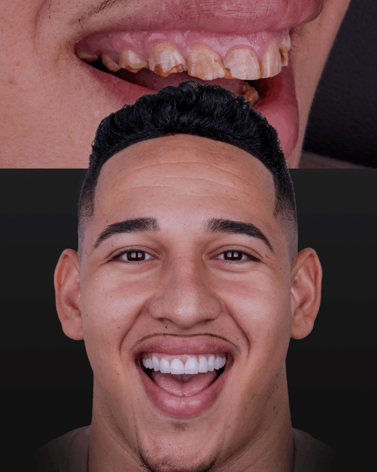 CASOS-PÁGINA-DE-CAPTURA_01